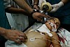 dottori palestinesi cercano di salvare un ragazzino (5)