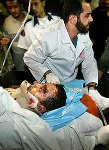 palestine ferito dopo un attacco